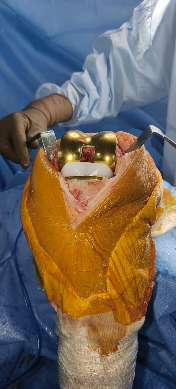 Dr. Jigar Sundesha treating patient