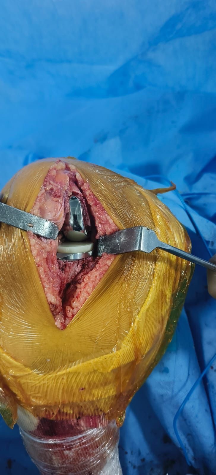 Dr. Jigar Sundesha professional moment